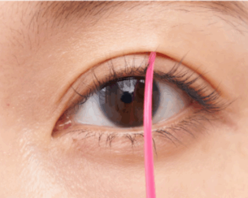 二重幅を自然に見せるための工夫