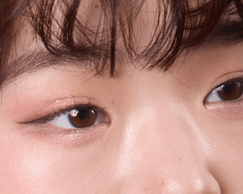 二重幅を自然に見せるための工夫